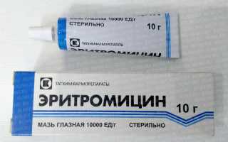 Клиндамицин или эритромицин наружно