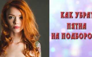 Красные пятна на подбородке у ребенка: причины, диагностика, варианты лечения