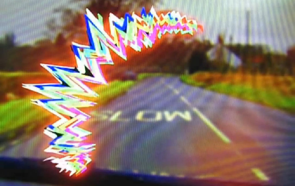 Глазная мигрень или мерцательная скотома