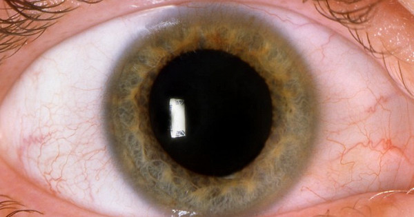 Диаметр зрачка