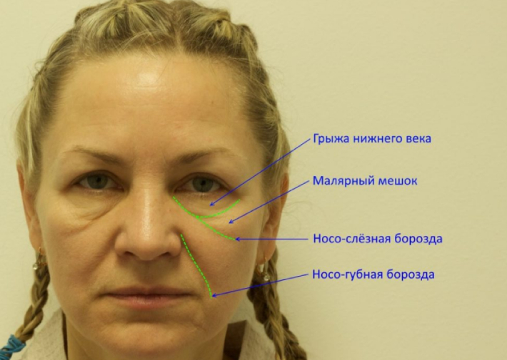 Хирургическое вмешательство