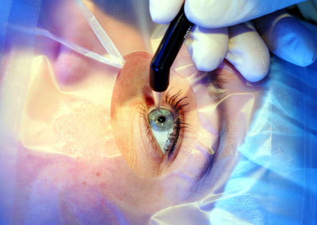 Что такое миопический астигматизм - причины и лечение