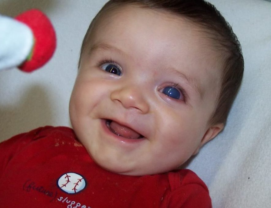 Осложнения