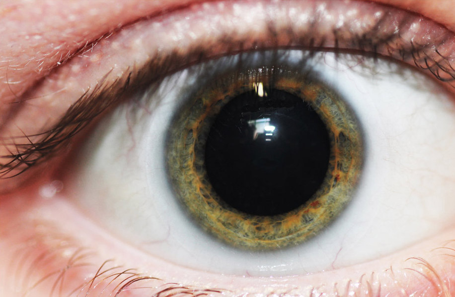 Почему зрачок не реагирует на свет
