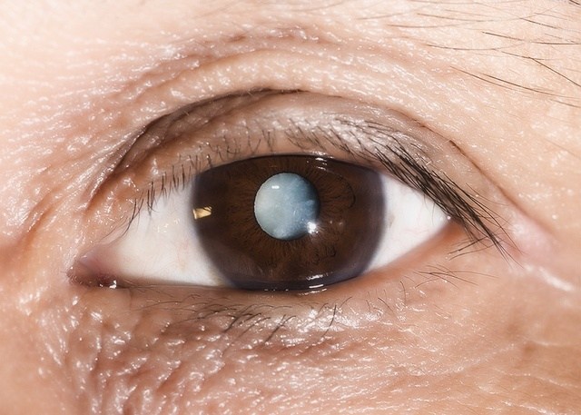 Белая точка в глазу