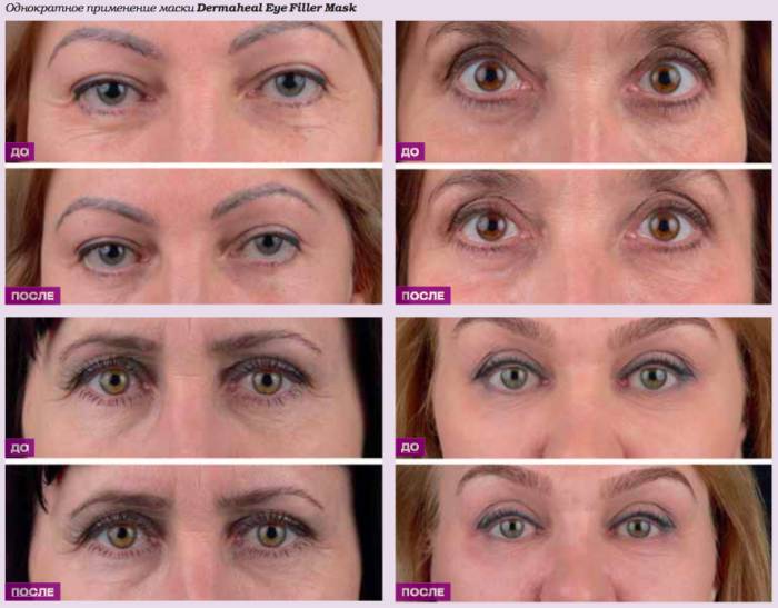 Фото до и после