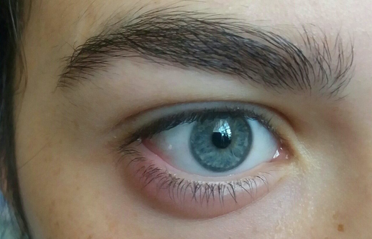 Медикаменты