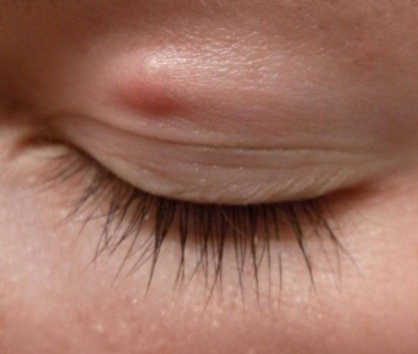 Профилактика