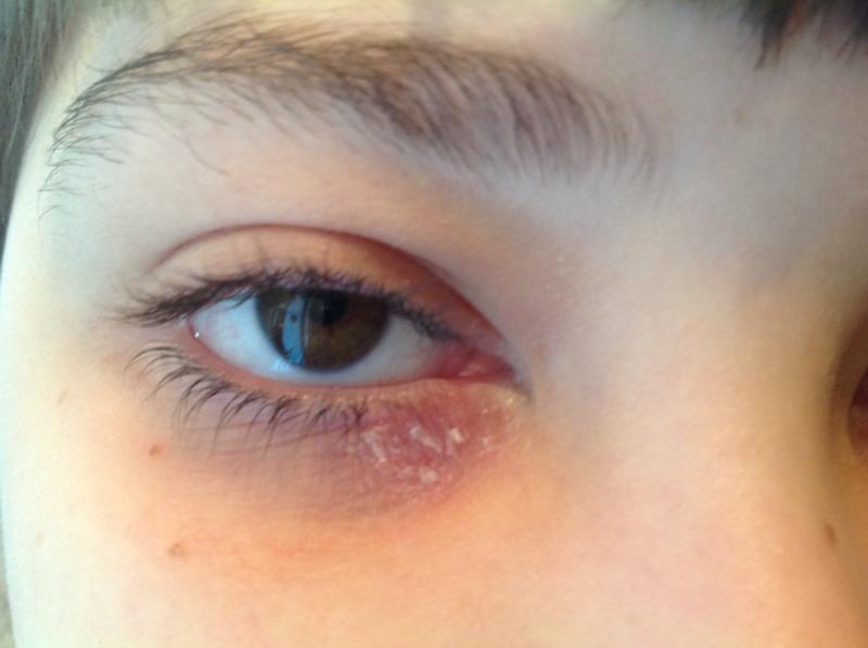 Аптечные препараты