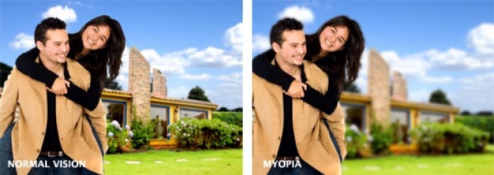 Зрение минус 2