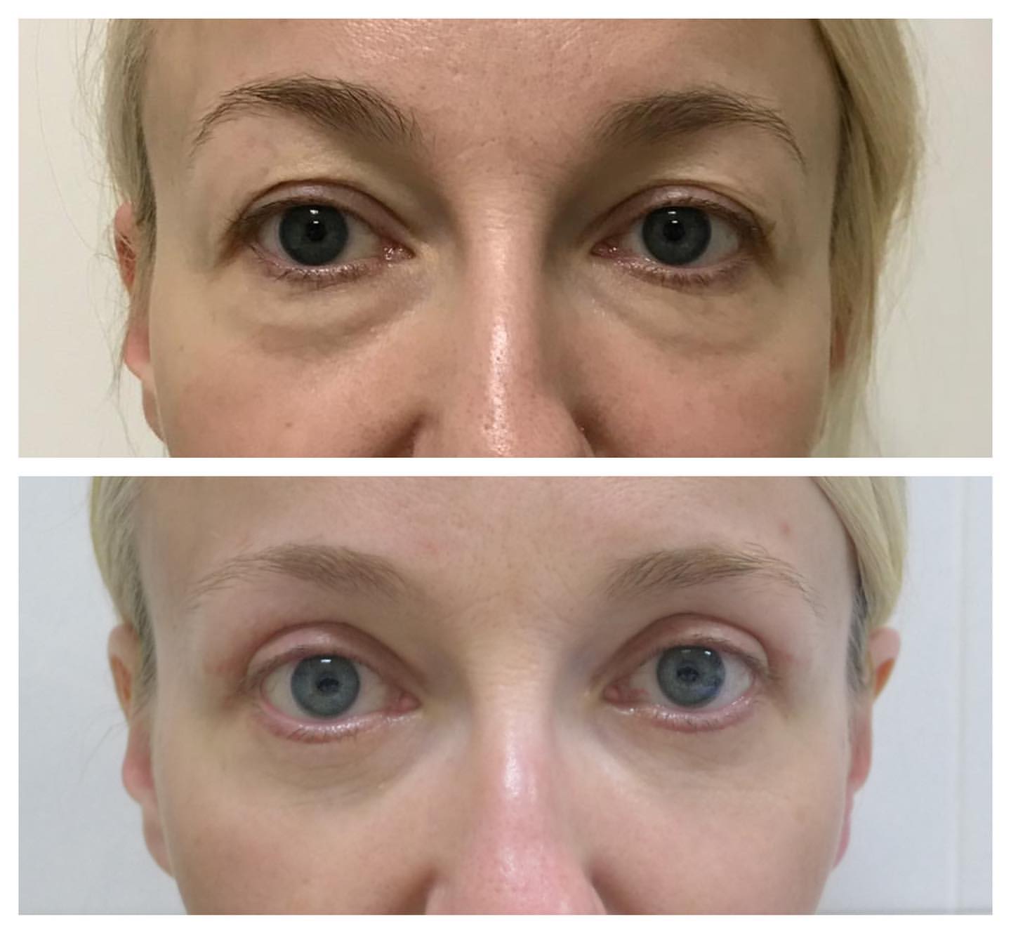 Хирургическое лечение