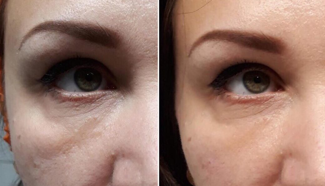 Косметические процедуры