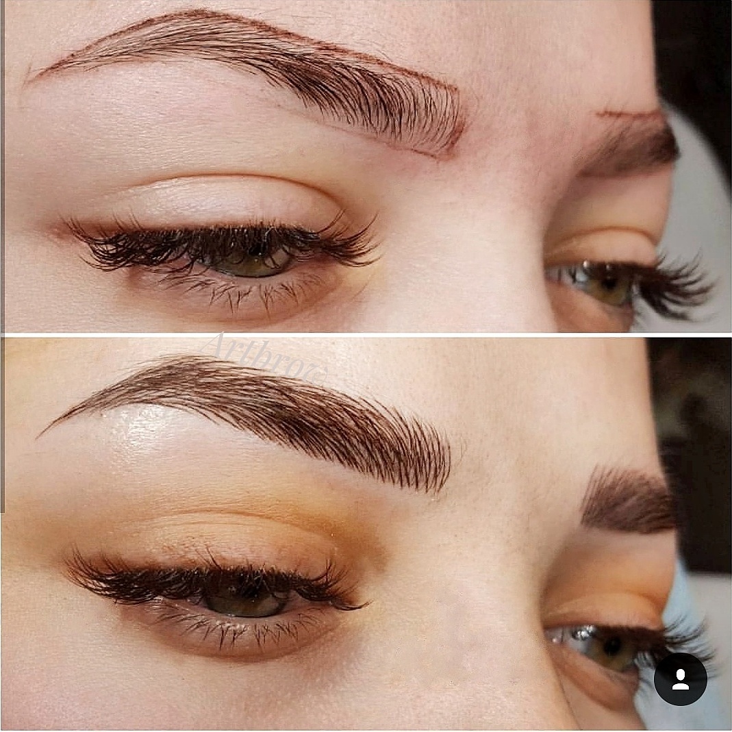 Фото до и после