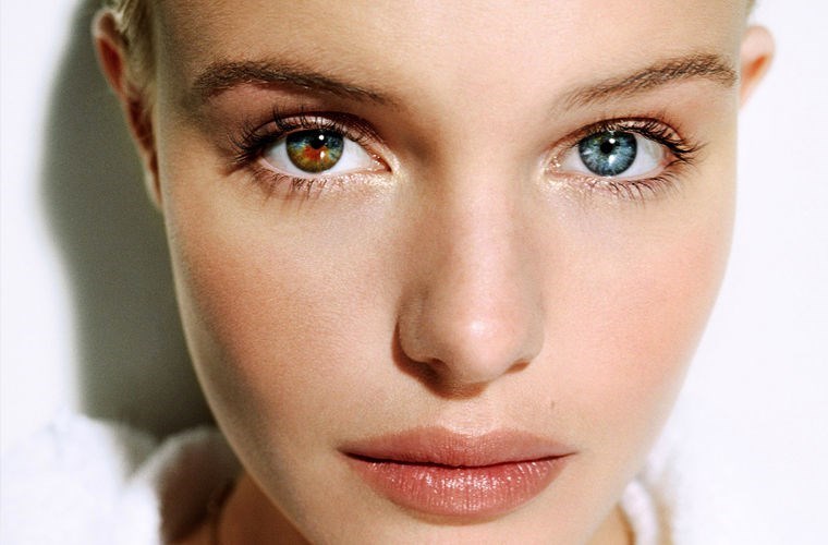 Что такое гетерохромия глаз