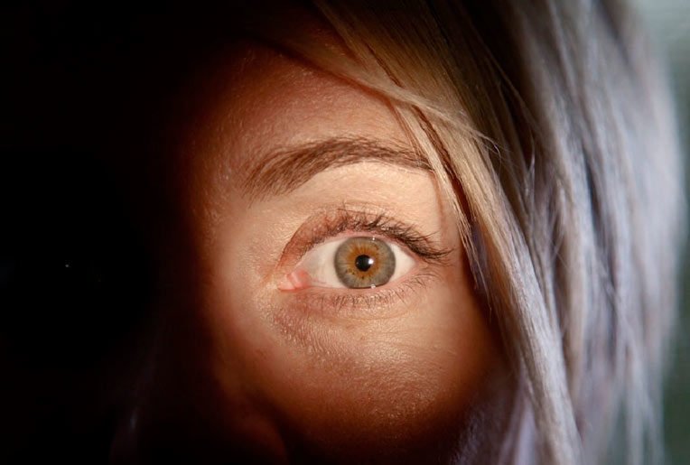 Что такое курина слепота