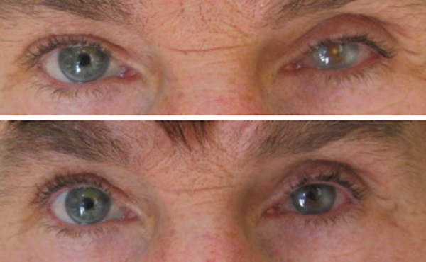 Фото до и после