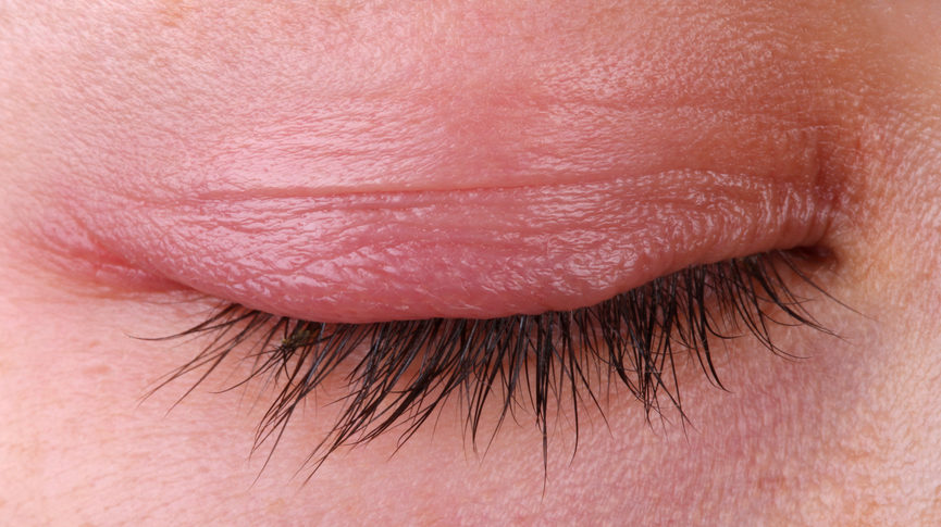 Почему болит верхнее или нижнее веко