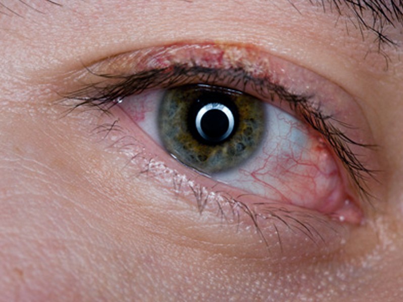 Группа риска