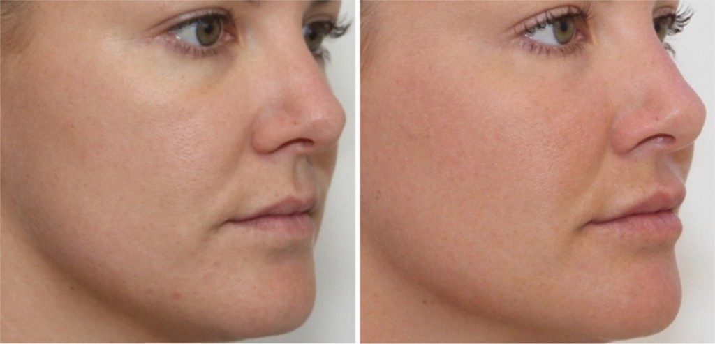 Крема и маски