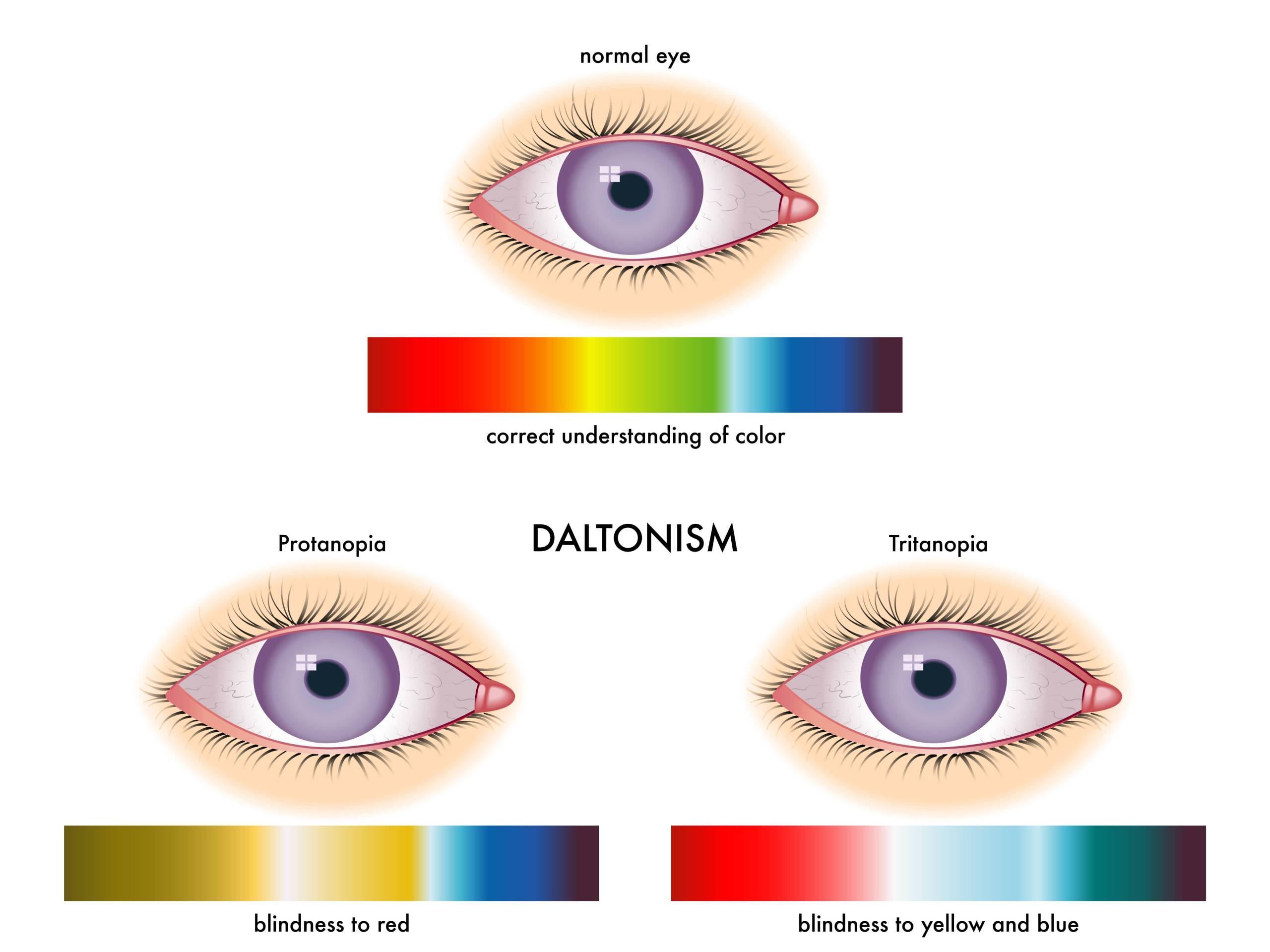 Почему глаза видят цвета по-разному
