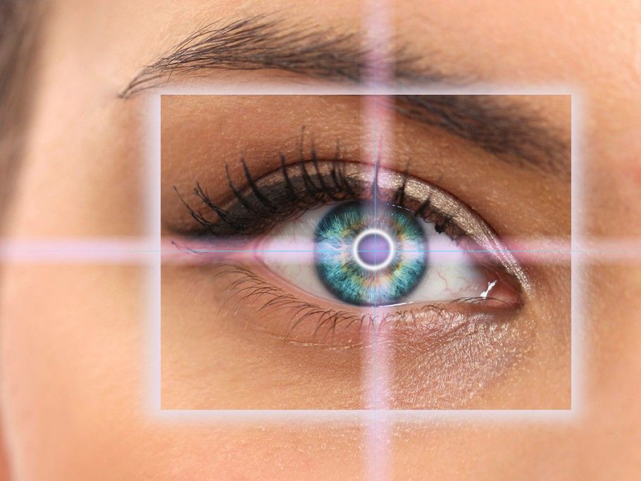 Мультифокальные