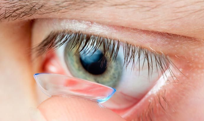 Что такое дальнозоркость у взрослых и детей