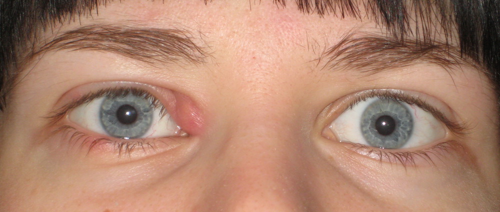 Группа риска