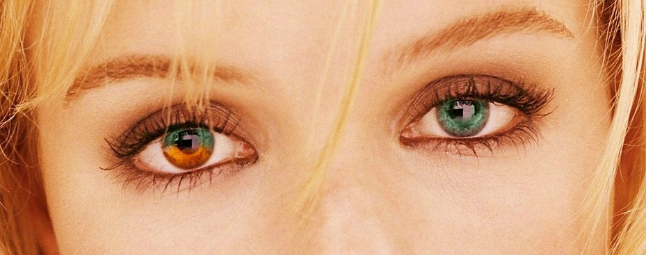 Разноцветные глаза у человека