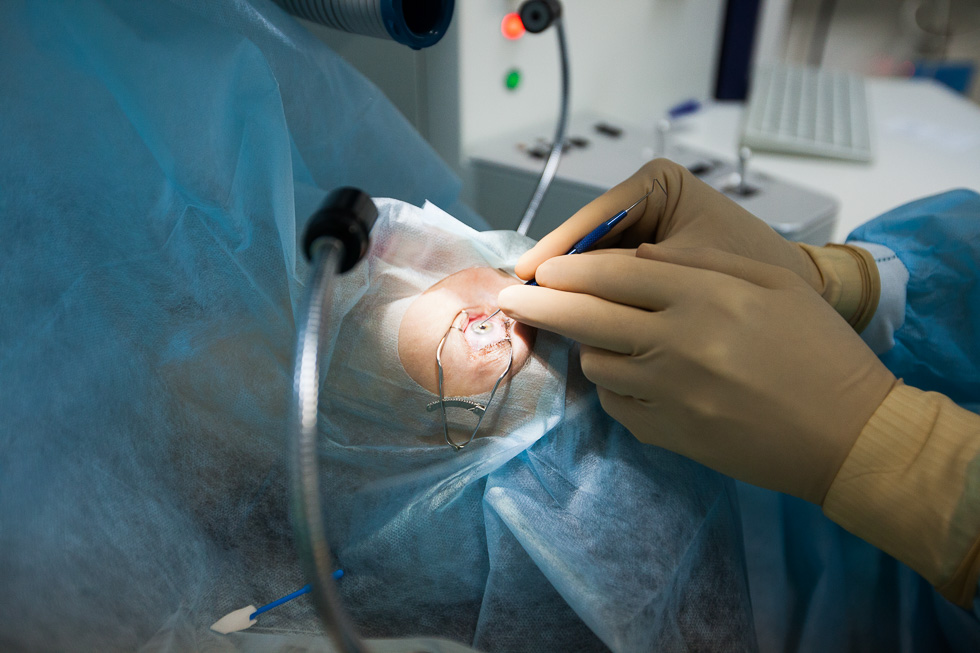 Склеропластика глаз