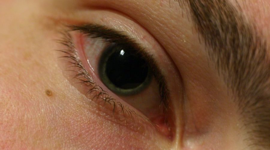 Почему расширяются зрачки