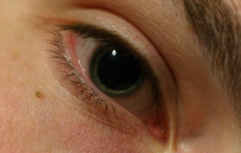 Способы расширения зрачков в домашних условиях