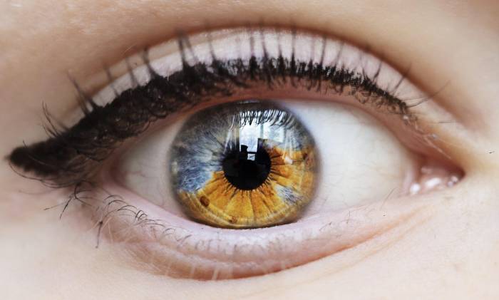 Что такое гетерохромия глаз