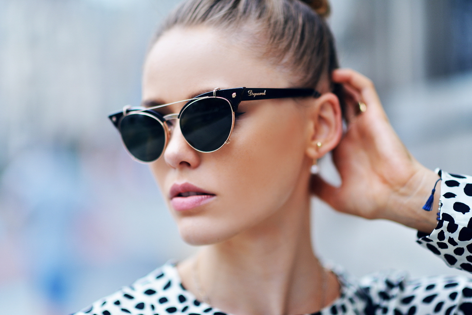 Глазной альбинизм