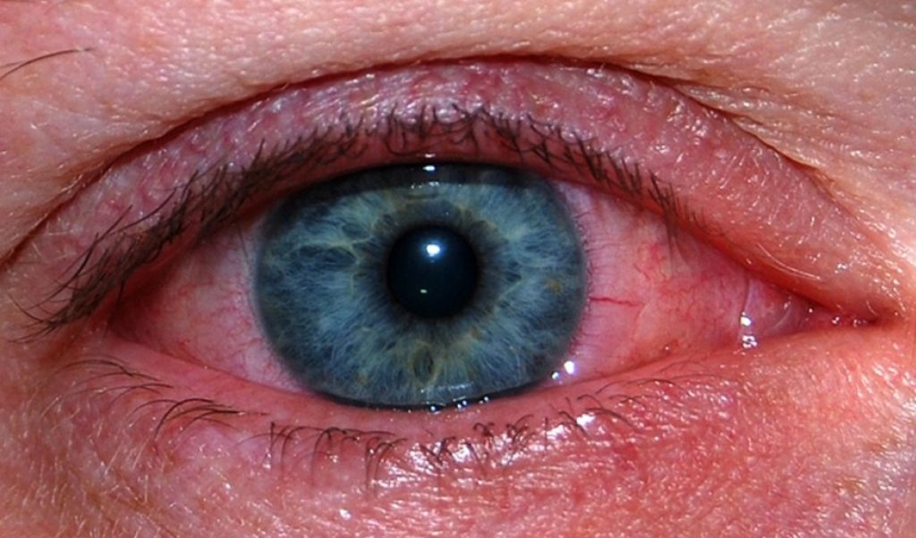 красные глаза