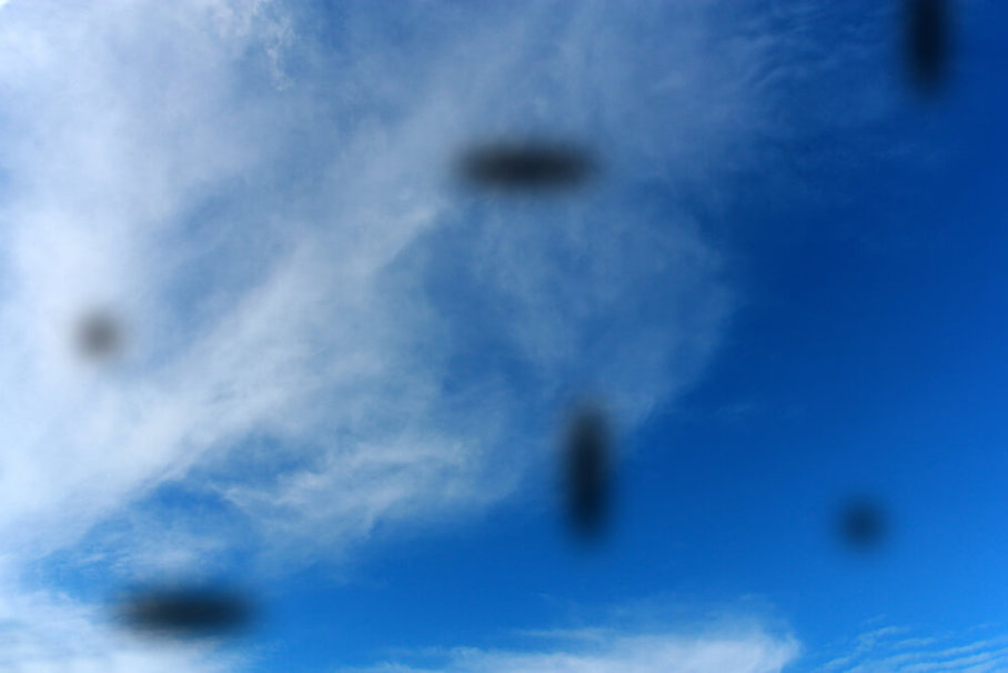 Почему летают черные точки в глазах