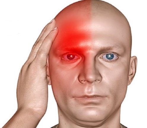 Почему болит глаз и голова с правой стороны