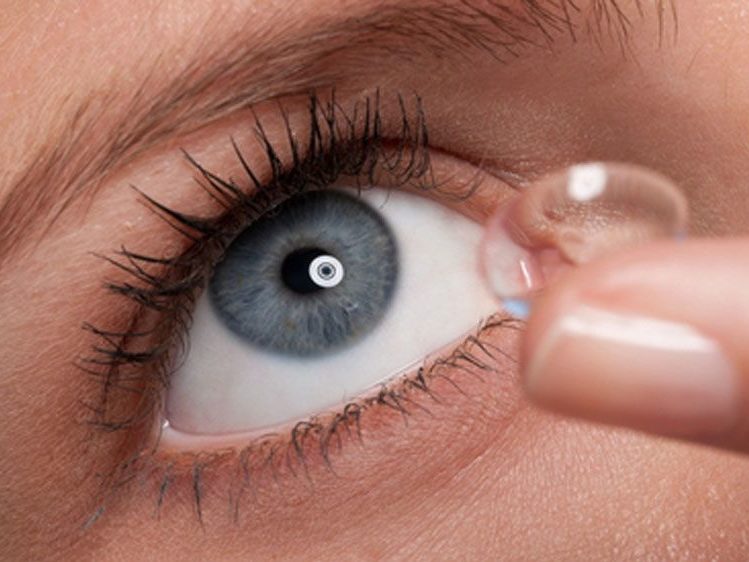 Виды контактных линз