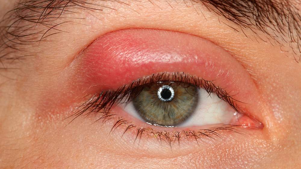 Осложнения