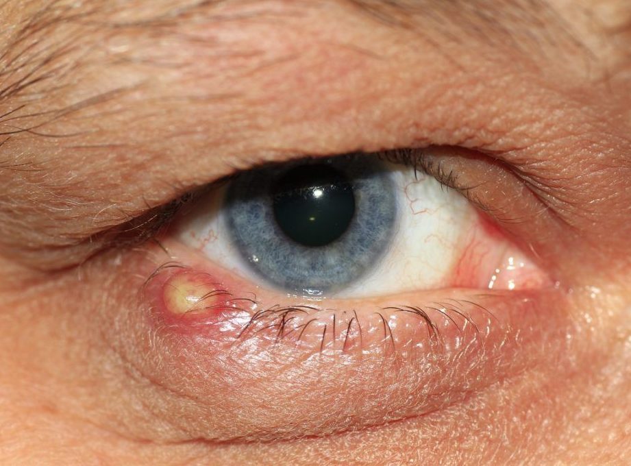 Природа возникновения заболевания