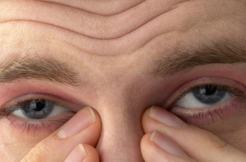 Почему щиплет глаза