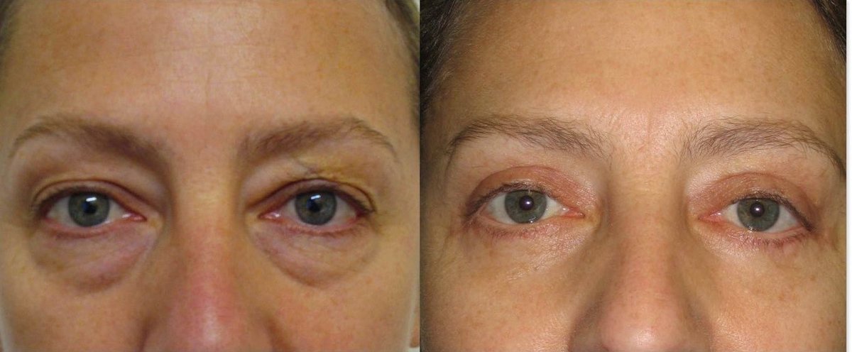 Диагностика