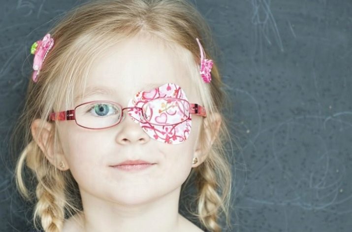 Перекрытие здорового органа зрения