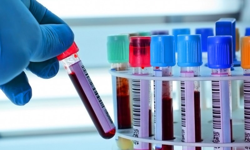 Гемофтальм