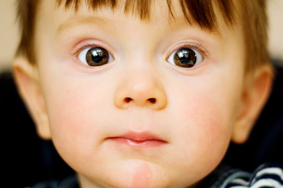 Почему у подростка или ребенка большие зрачки