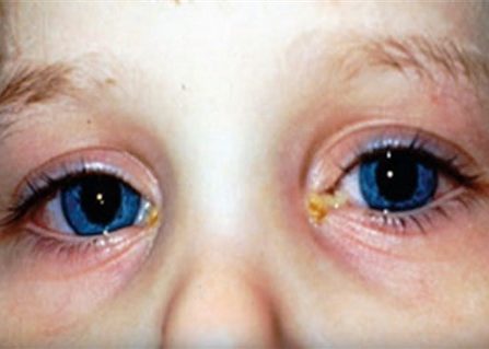 Что говорит доктор Комаровский