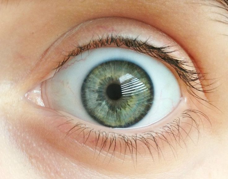 Что такое парез аккомодации