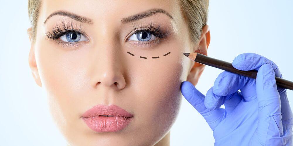 слезная борозда