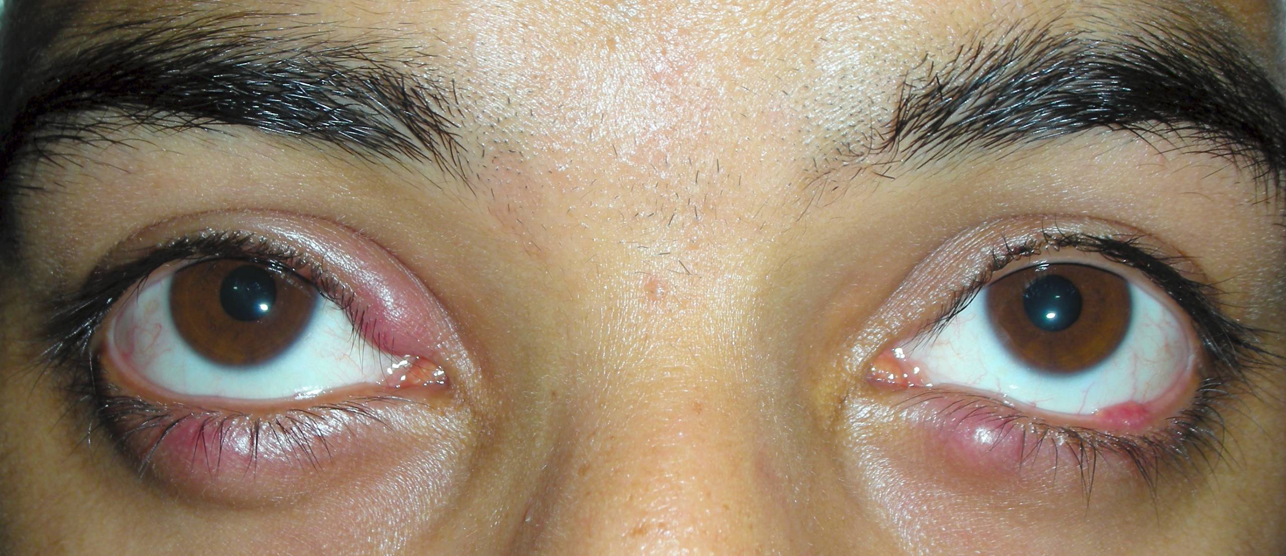 Диагностика