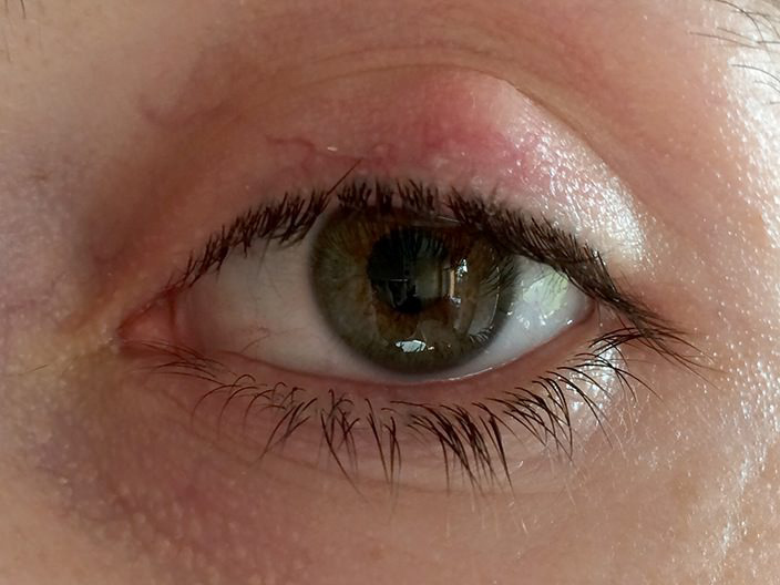 Медикаментозное