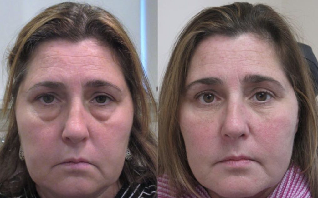 Косметологические процедуры